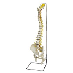 Anatomisches Modell "Wirbelsäule mit Bandscheibenvorfall"